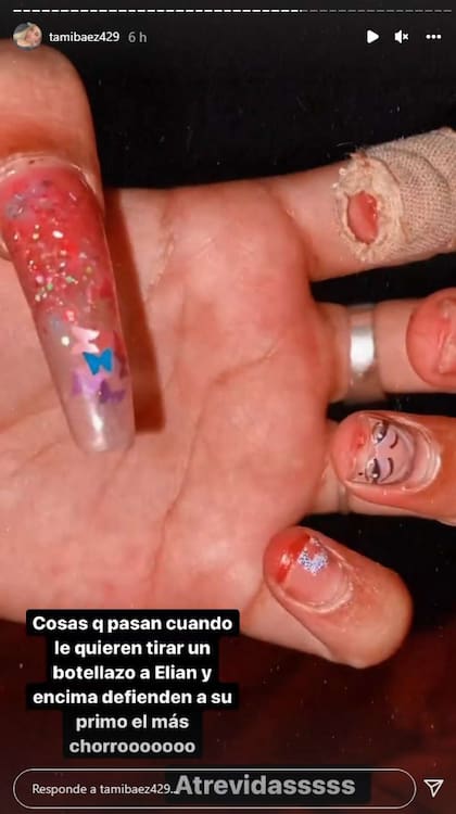 La impactante imagen compartida por Tamara. Fuente: Instagram