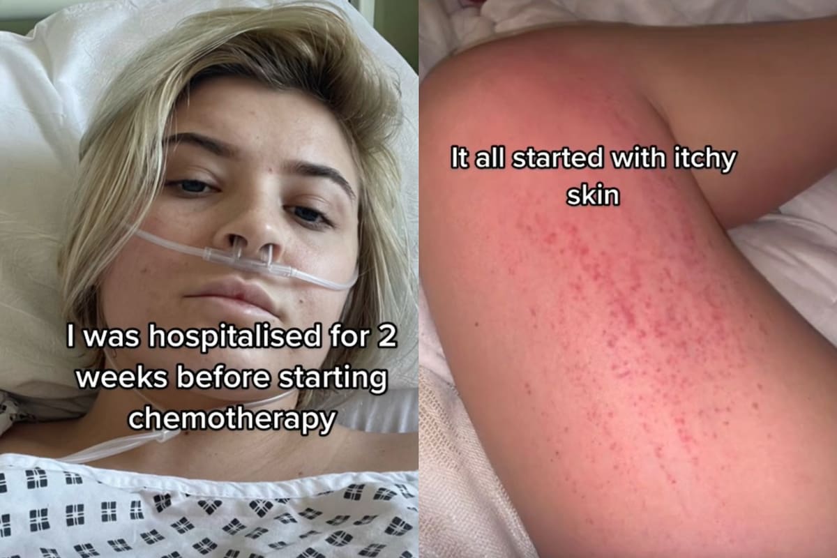 La influencer logró sobrevivir a una difícil situación, luego de creer que era una simple alergia