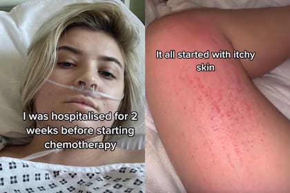 La influencer logró sobrevivir a una difícil situación, luego de creer que era una simple alergia