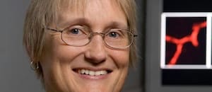 Katrin Andreasson, neuróloga de Stanford: “Ahora conocemos al menos una gran razón por la que envejecemos”