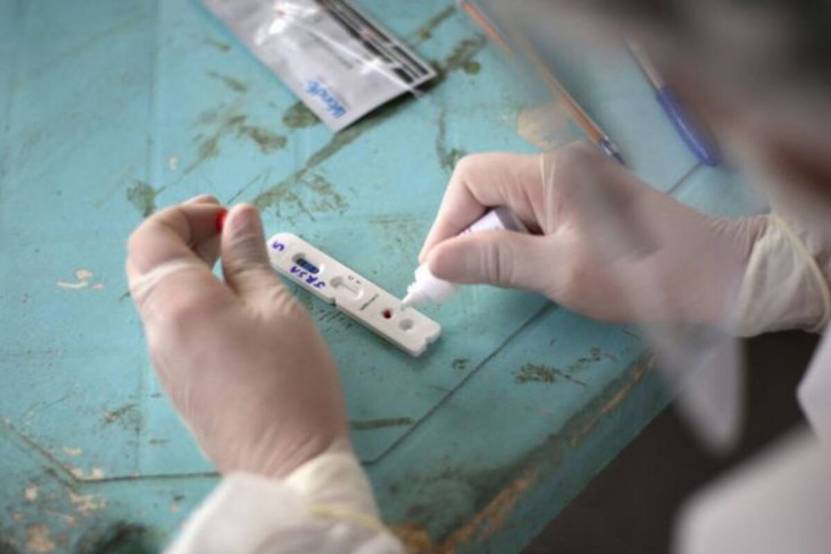 La investigación sobre la nueva variante se hizo con 31 muestras de pacientes con covid-19 en la capital de Amazonas