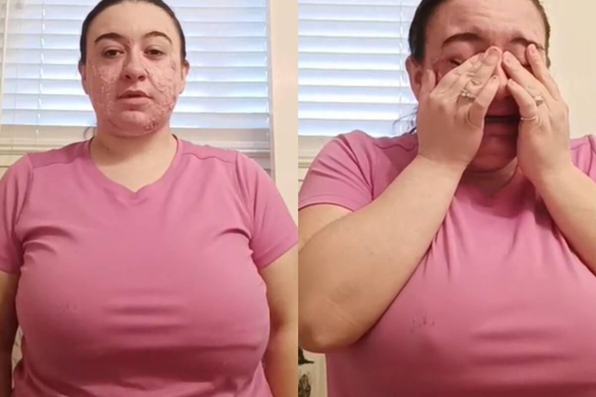 La joven contó cómo una enfermedad le cambió drásticamente la vida (Captura video)