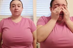La joven contó cómo una enfermedad le cambió drásticamente la vida (Captura video)