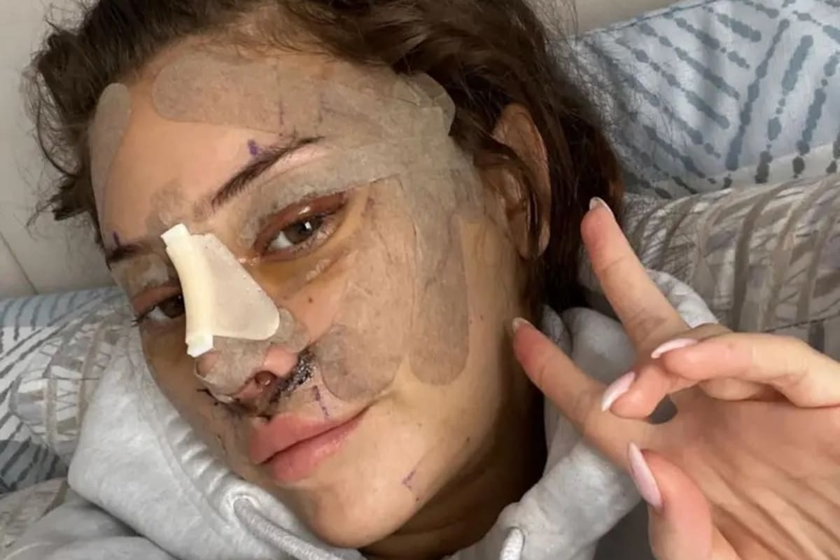 La joven Emily compartió fotos tras someterse a cirugía estética
@hotgirlenhancements