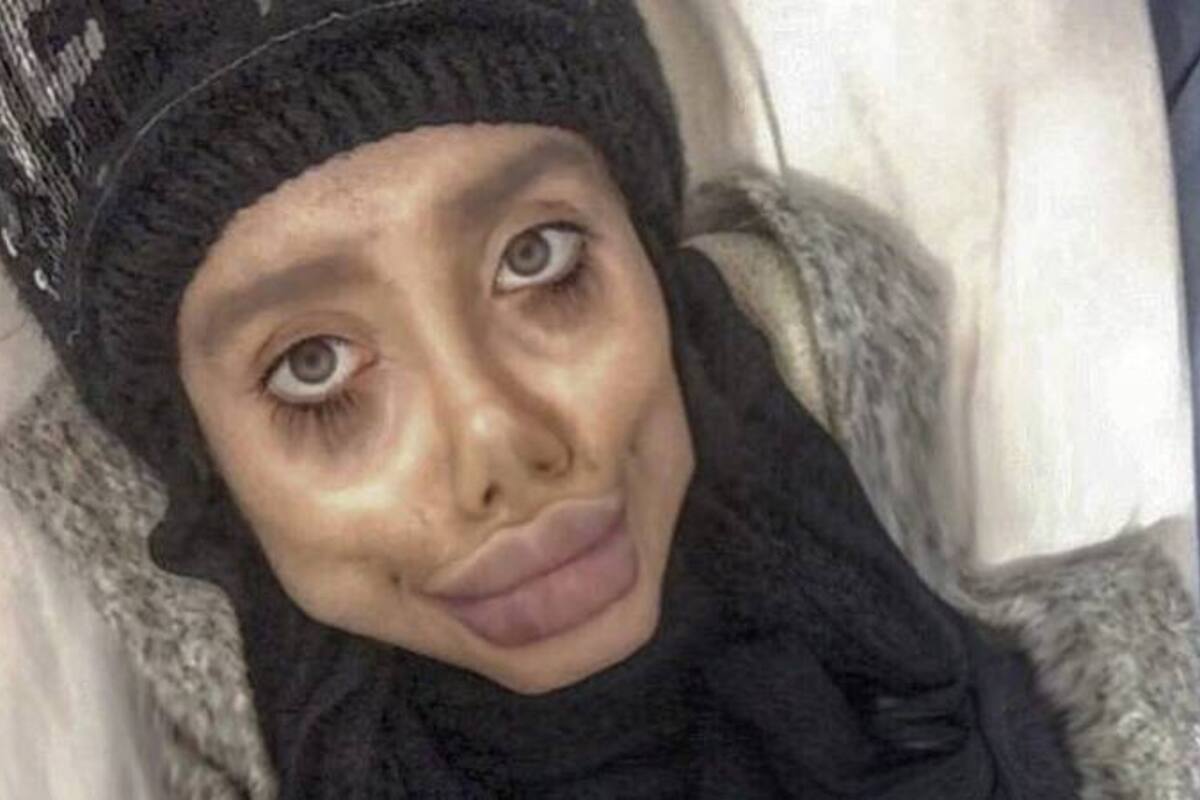 La joven iraní contó que no tiene hecha ninguna cirugía