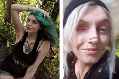 La joven madre decidió extirparse el ojo para que el cáncer no se propagara