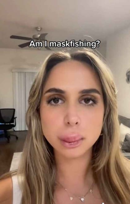 La joven mostró cómo quedaron sus labios post intervención. Fuente: TikTok