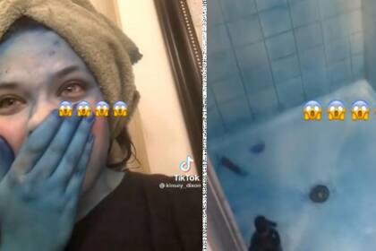 La joven resultó con la piel completamente azul después de un intento fallido de tinturarse el pelo