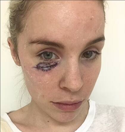 La joven se sometió a una cirugía para que le extirpen el tumor (Foto: Gentileza Daily Mail)