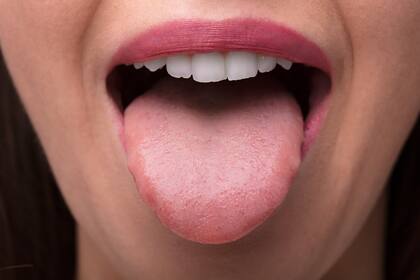La lengua no es solo un órgano sensorial, sino también un indicador importante de la salud general