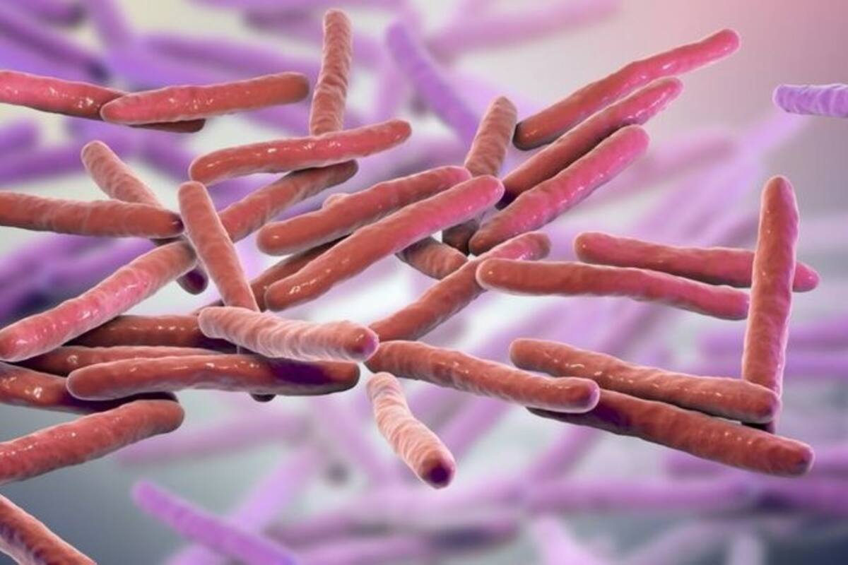 La lepra es causada por el bacilo Mycobacterium leprae.