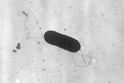 La Listeria monocytogenes es una bacteria que puede desarrollarse en condiciones de frío, por lo que es capaz de multiplicarse dentro del refrigerador con el tiempo, lo que representa un riesgo potencial para la salud (Elizabeth White/CDC vía AP, Archivo)