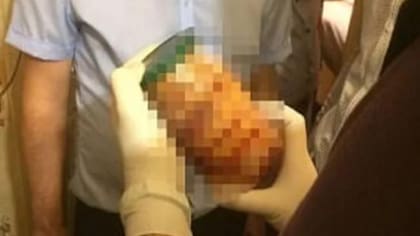 La macabra historia de la "pareja caníbal": fueron detenidos en su domicilio
Foto: elnacional.com