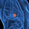 Cuándo hay que hacerse una mamografía si hay antecedentes familiares de cáncer de mama