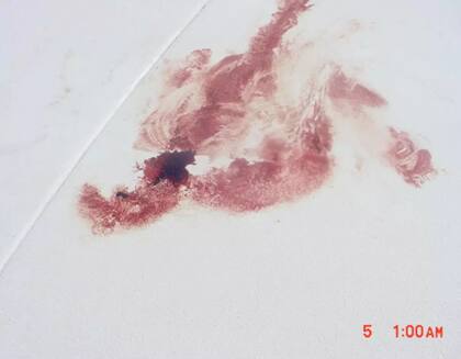 La mancha de sangre a un costado del crucero