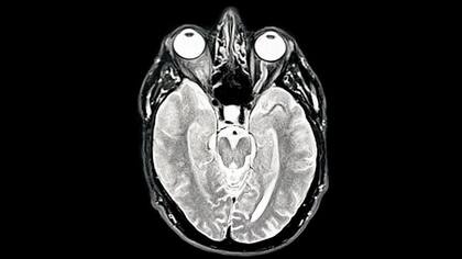 La manera en la que el cerebro cambia las conexiones a lo largo de la vida podría ayudar a “comprender mejor los cambios relacionados en la cognición y el comportamiento”.