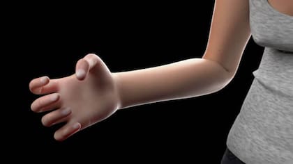 La mano se deformará como consecuncia del uso continuo de los smarthphones