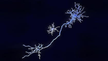 La microglía protege nuestro cerebro de las infecciones al buscar y destruir bacterias y virus.
