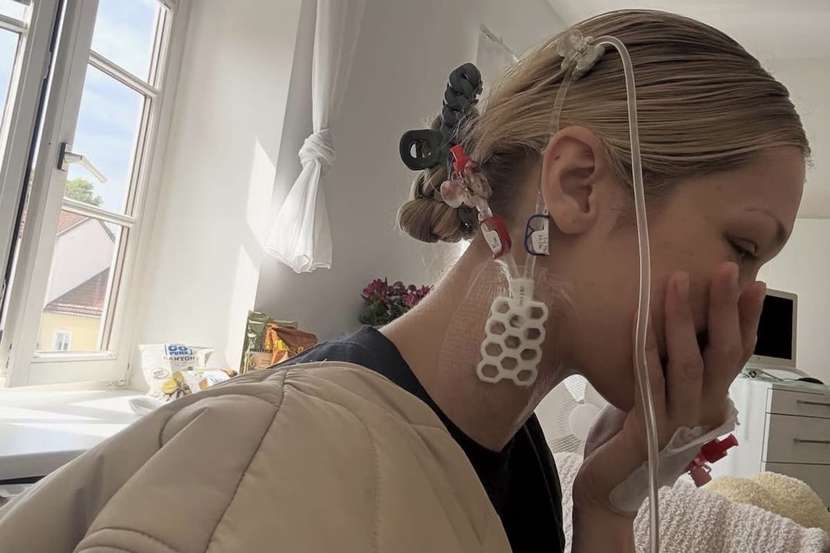 La modelo compartió imágenes de su tratamiento