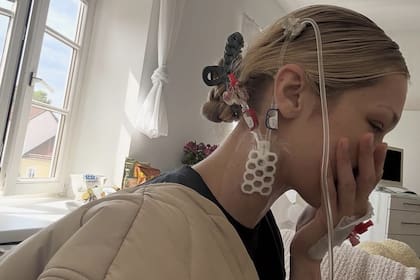 La modelo compartió imágenes de su tratamiento