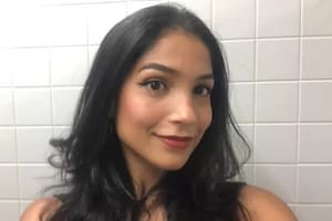 La modelo Kesia Nascimento descubrió que tenía el síndrome a los 17 años