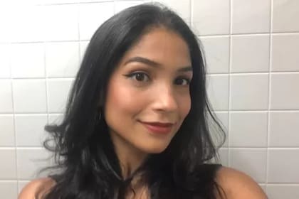 La modelo Kesia Nascimento descubrió que tenía el síndrome a los 17 años