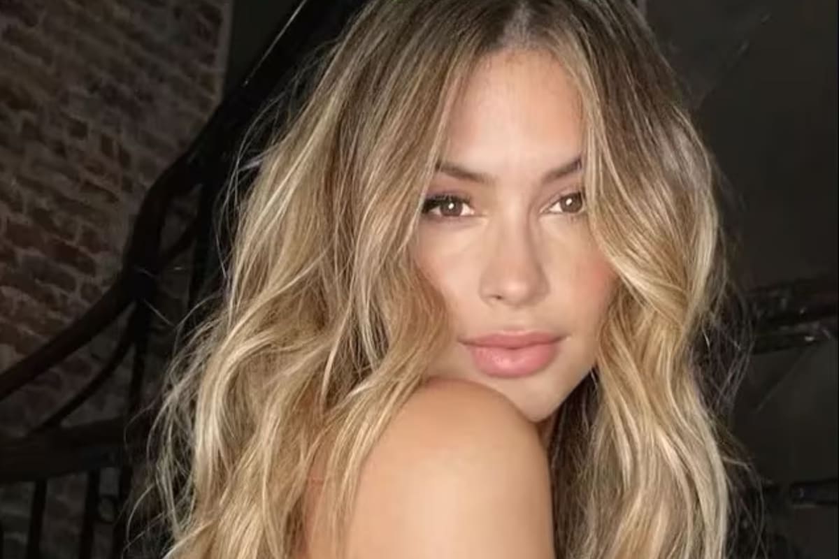 La modelo peruana fue diagnosticada con desplazamiento de vértebra