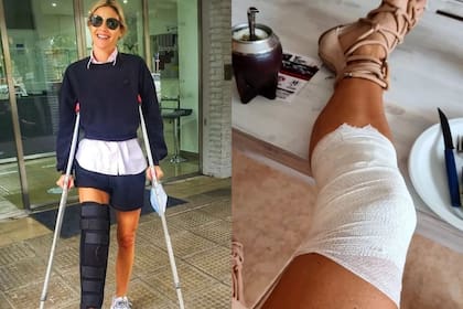 La modelo Pía Slapka sufrió un accidente mientras jugaba con sus hijos y compartió imágenes luego de su operación