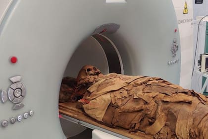 La momia será sometida a una tomografía computarizada para saber el modo de vida que tuvo en la época antigua