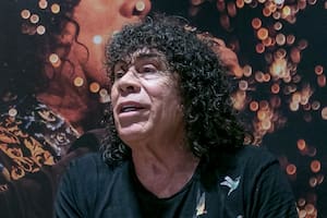 Operaron a Carlos “La Mona” Jiménez tras su histórico show en La Plata