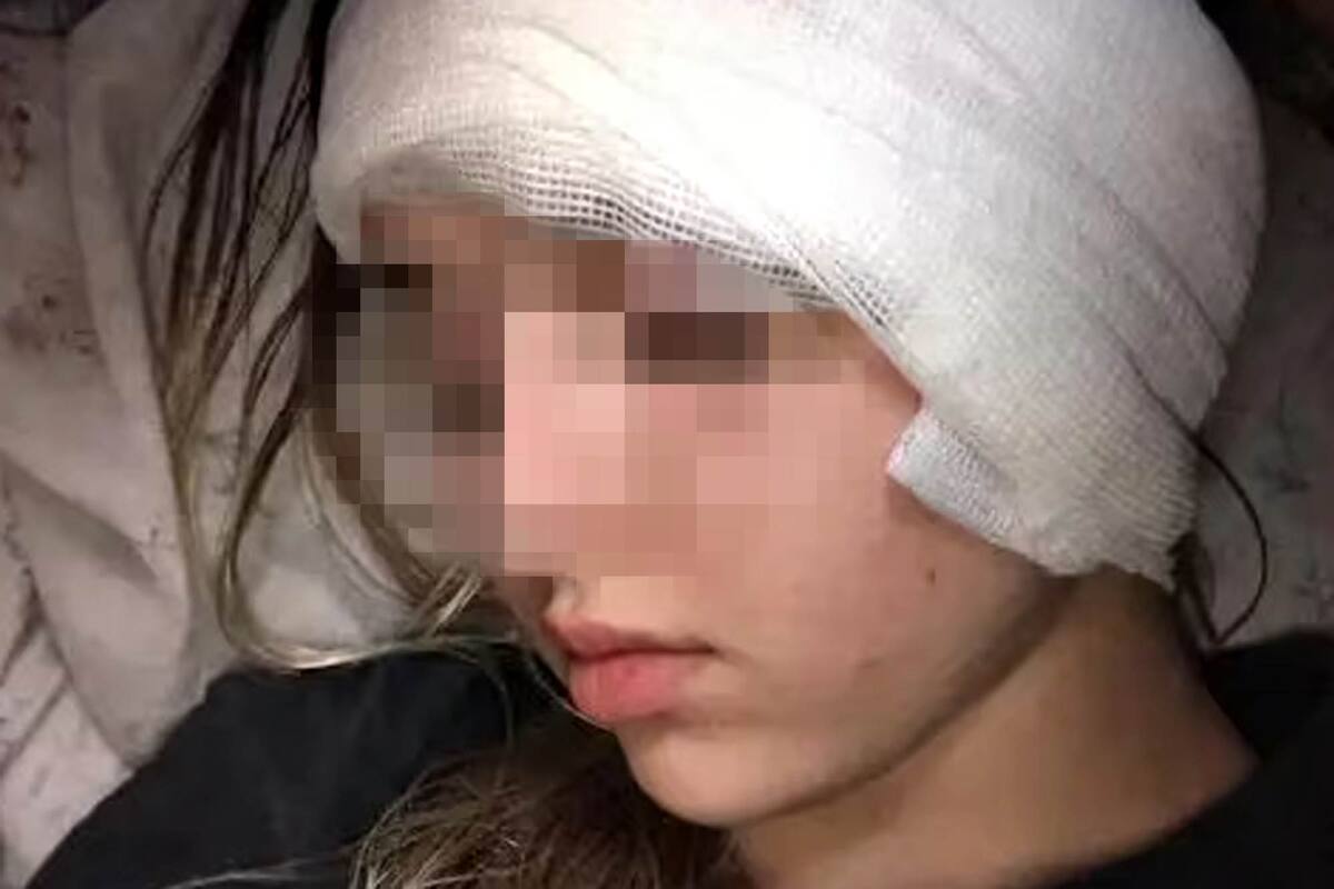 La moza que fue agredida en Mendoza