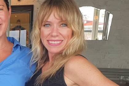 La mujer aseguró que hoy usa protector solar cada vez que sale de su hogar