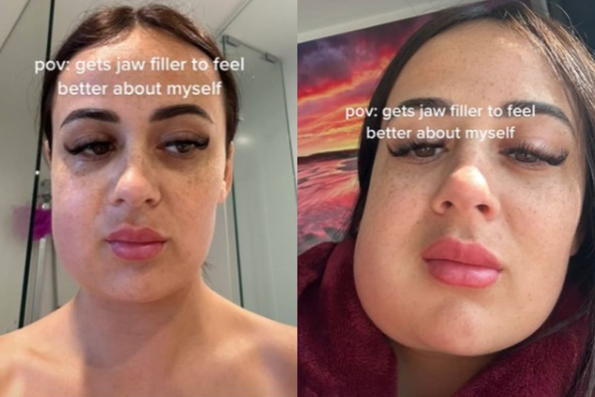 La mujer australiana se realizó una operación y no salió como esperaba (Foto: TikTok: @jodieva)