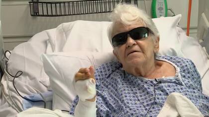 La mujer de Florida recibió mordeduras en su pierna y en los dedos de su mano derecha