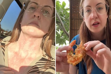 La mujer descubrió en Europa cuál era el verdadero causante de sus malestares