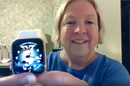 La mujer descubrió que tenía un tumor gracias a su Apple Watch