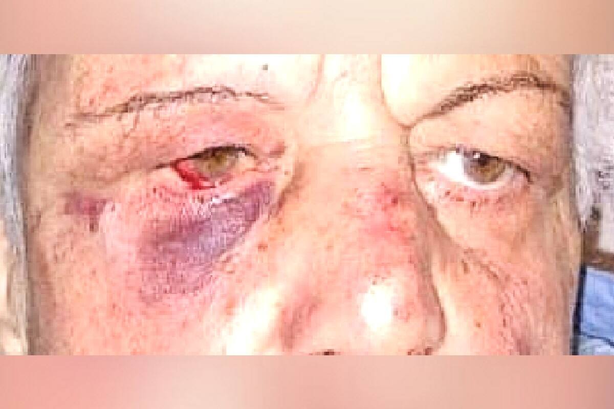 La mujer fue golpeada por los tres delincuentes