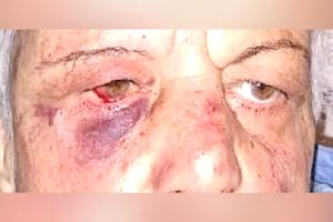 La mujer fue golpeada por los tres delincuentes