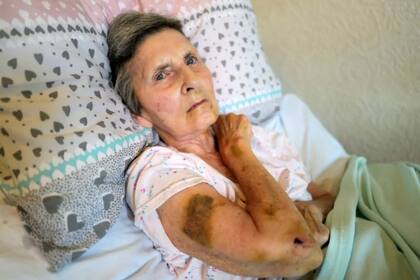 La mujer fue llevada al hospital donde estuvo internada por varios días