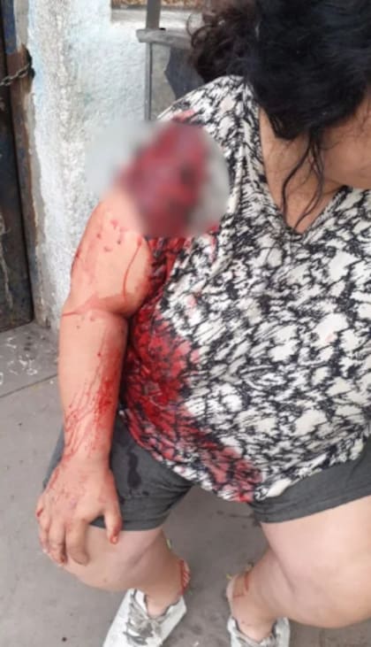 La mujer herida tras ser atacada por su hija en Ensenada