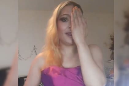 La mujer mostró cómo terminó su rostro tras hacer un reto viral (Captura video)