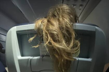 La mujer mostró lo que veía (Foto Reddit)