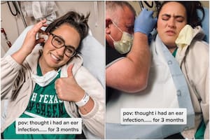 La mujer pensó que tenía una infección en el oído, pero resulta que tuvieron que removerle un curioso objeto