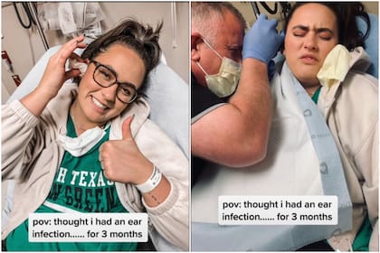La mujer pensó que tenía una infección en el oído, pero resulta que tuvieron que removerle un curioso objeto