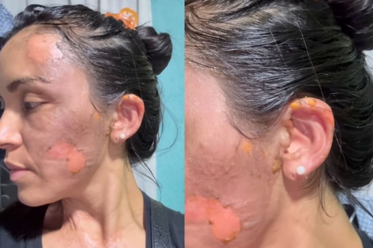 La mujer posteó sus heridas del ataque en las redes sociales.