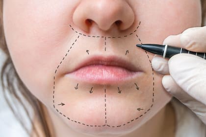 La mujer quedó en estado vegetativo tras las intervenciones estéticas. Foto ilustrativa.