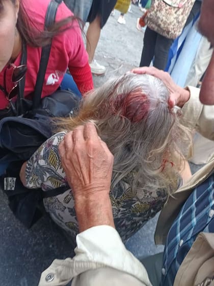 La mujer resultó herida y en el suelo durante varios minutos