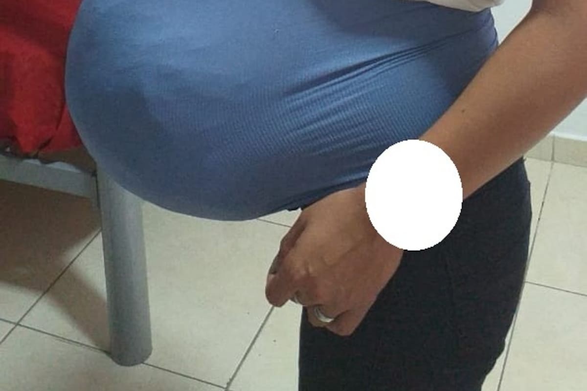 La mujer simulaba estar embarazada. Llevaba 15 paquetes de marihuana en una carcasa hecha con engrudo.