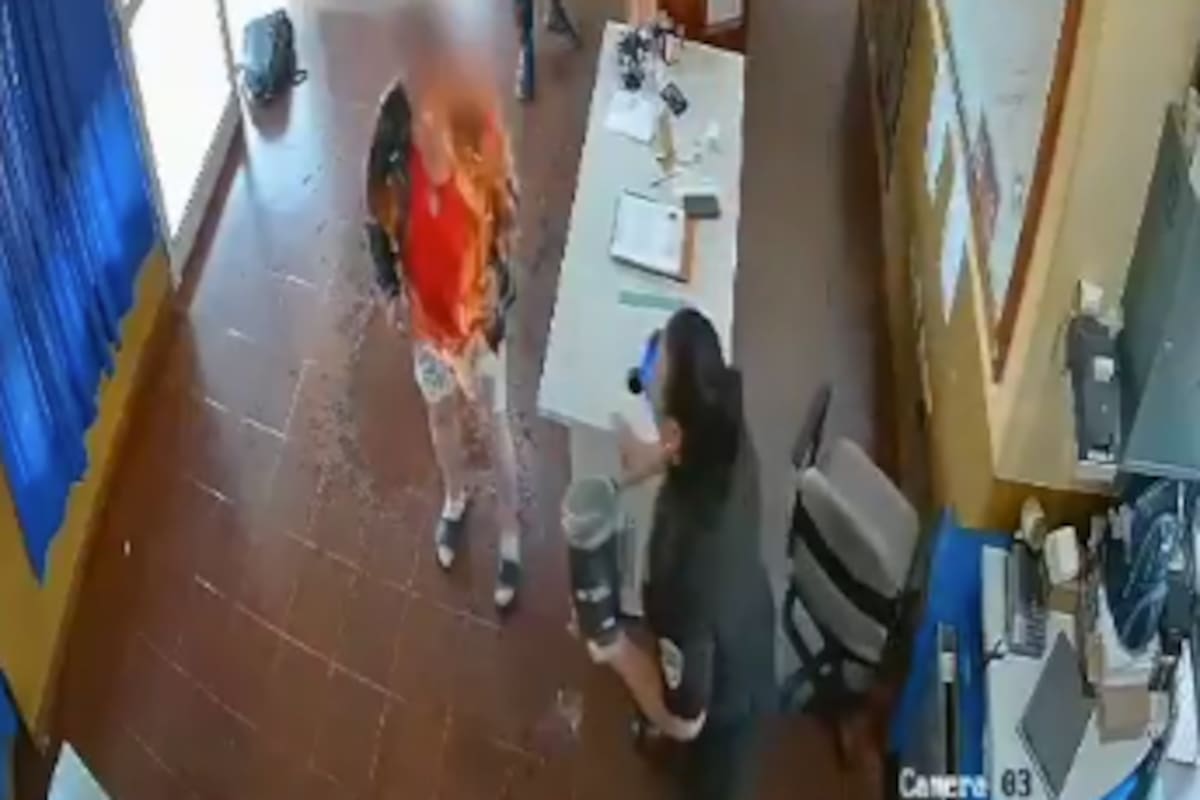 La mujer sufrió quemaduras en el 35% del cuerpo