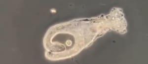Así actúa el naegleria fowleri, el extraño microorganismo que contrajo el niño fallecido en Catamarca